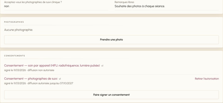 Fiche patiente : l'anamnèse remplie, le bloc photographies, et le consentement pour soin par appareil signé le 15/04/2026 dans sa version 1, avec la mention « diffusion non autorisée ».